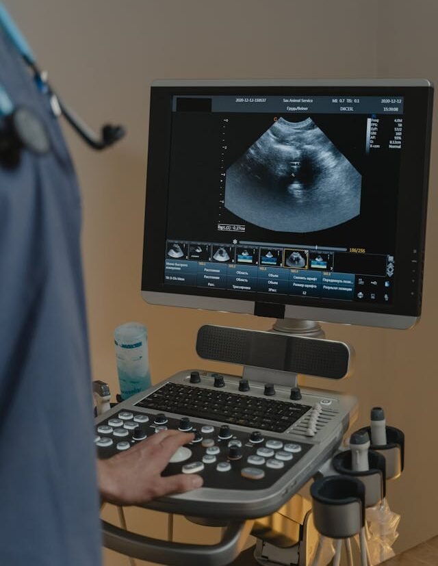 Ultrasonography USG e1764338969168